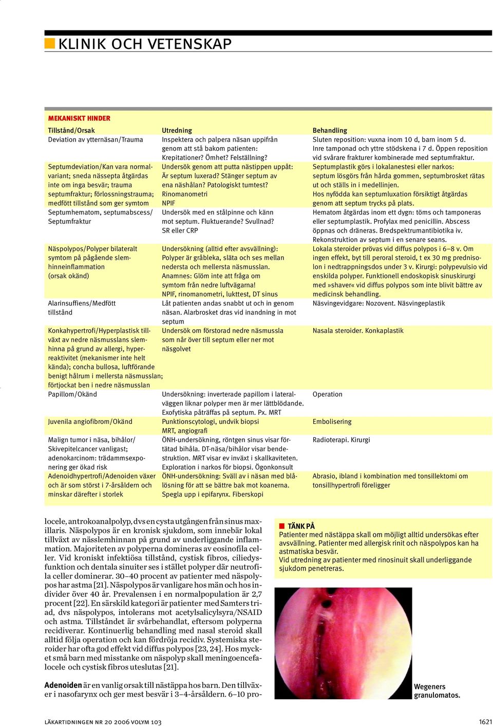 genom att stå bakom patienten: Inre tamponad och yttre stödskena i 7 d. Öppen reposition Krepitationer? Ömhet? Felställning? vid svårare frakturer kombinerade med septumfraktur.