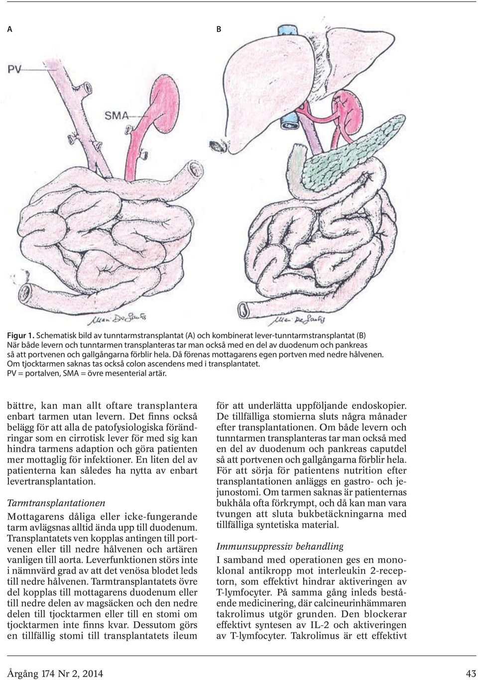 portvenen och gallgångarna förblir hela. Då förenas mottagarens egen portven med nedre hålvenen. Om tjocktarmen saknas tas också colon ascendens med i transplantatet.