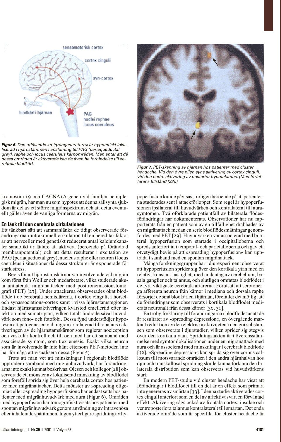 Vid den övre pilen syns aktivering av cortex cinguli, vid den nedre aktivering av posterior hypotalamus. (Med författarens tillstånd [33].