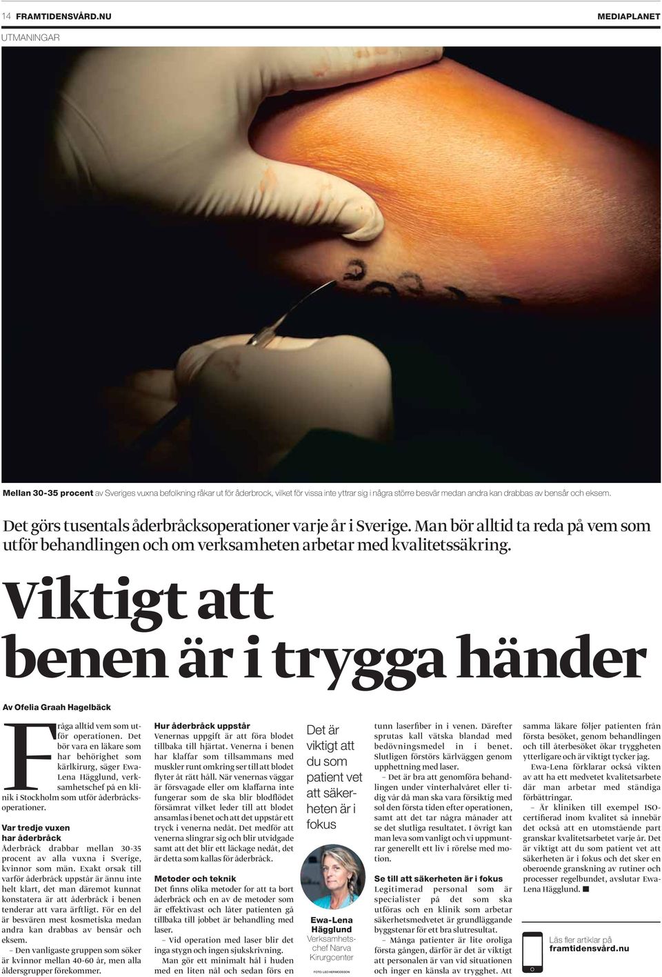 Det görs tusentals åderbråcksoperationer varje år i Sverige. Man bör alltid ta reda på vem som utför behandlingen och om verksamheten arbetar med kvalitetssäkring.