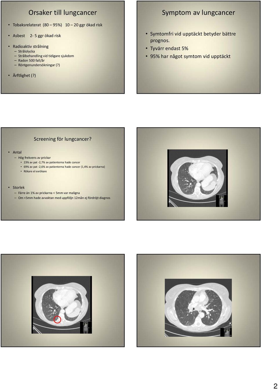 Tyvärr endast t5% 95% har något symtom vid upptäckt Ärftlighet (?) 7 8 Screening för lungcancer?