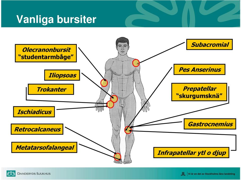 Prepatellar skurgumsknä Ischiadicus Retrocalcaneus