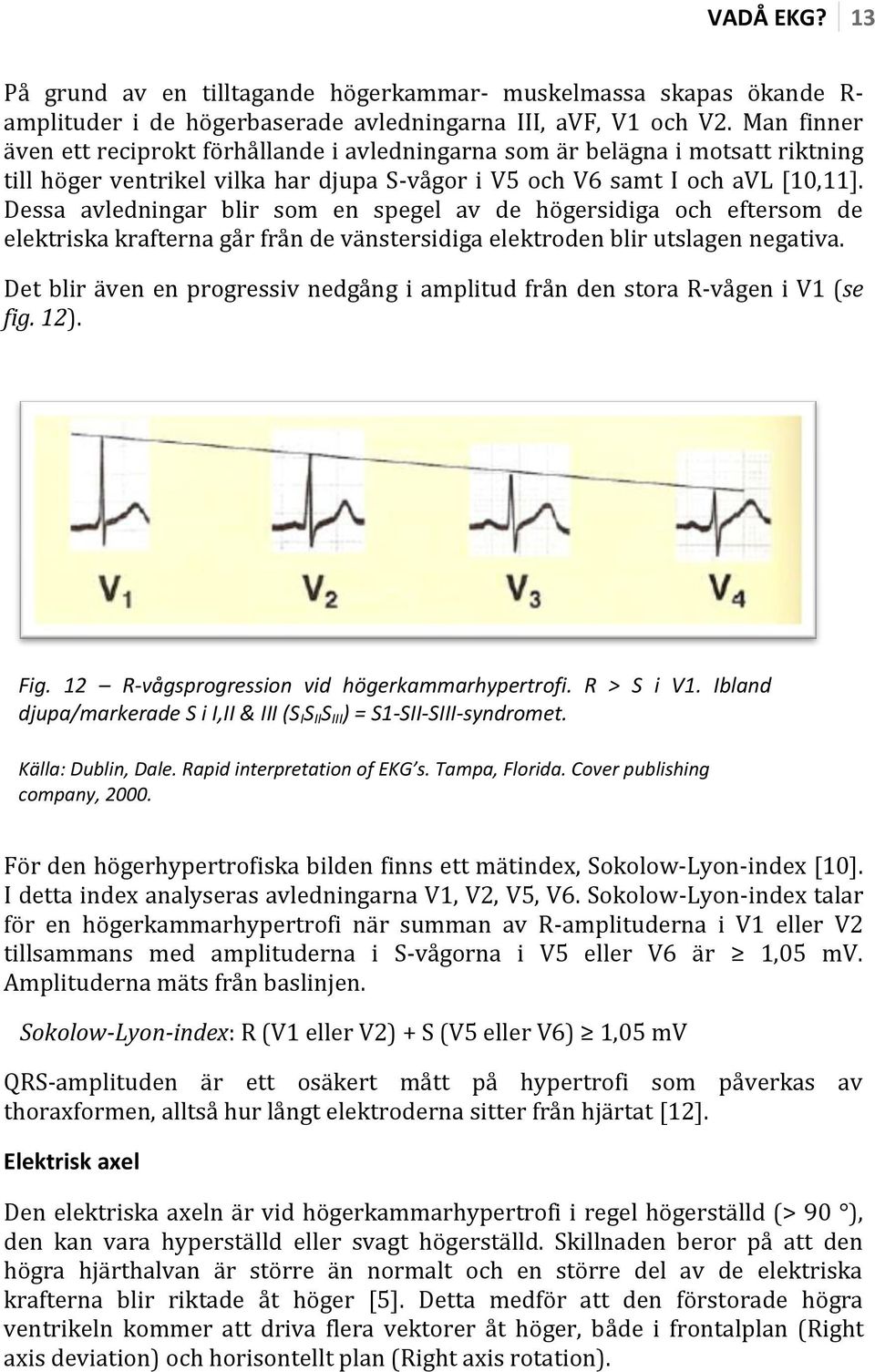 Dessa avledningar blir som en spegel av de högersidiga och eftersom de elektriska krafterna går från de vänstersidiga elektroden blir utslagen negativa.