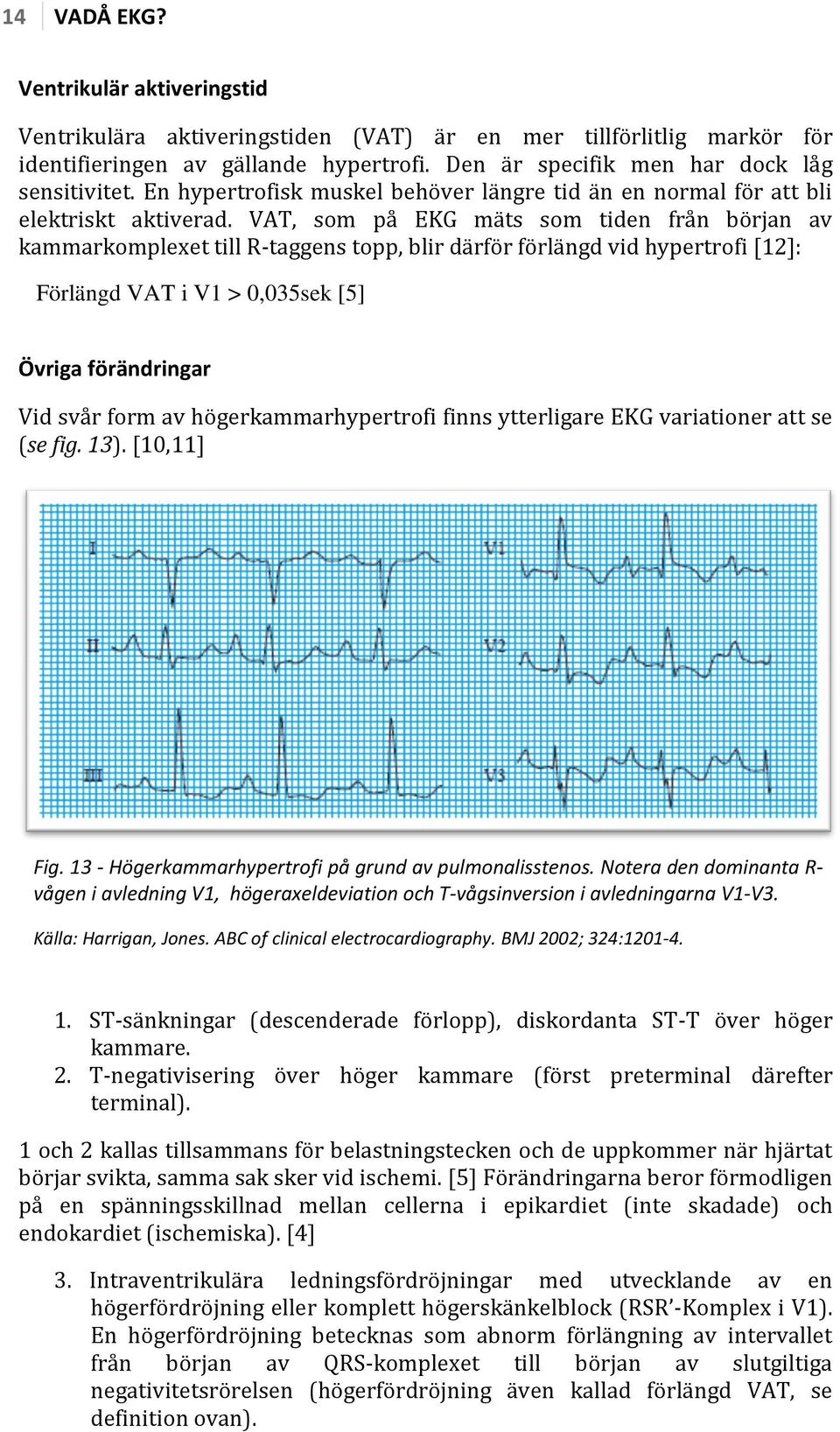 VAT, som på EKG mäts som tiden från början av kammarkomplexet till R-taggens topp, blir därför förlängd vid hypertrofi [12]: Förlängd VAT i V1 > 0,035sek [5] Övriga förändringar Vid svår form av