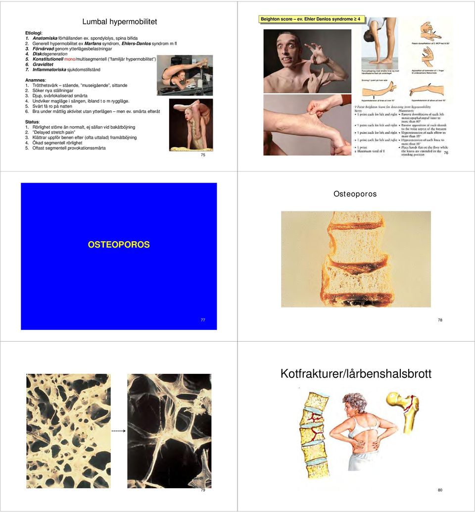 Konstitutionell mono/multisegmentell ( familjär hypermobilitet ) 6. Graviditet 7. Inflammatoriska sjukdomstillstånd Anamnes: 1. Trötthetsvärk stående, museigående, sittande 2. Söker nya ställningar 3.