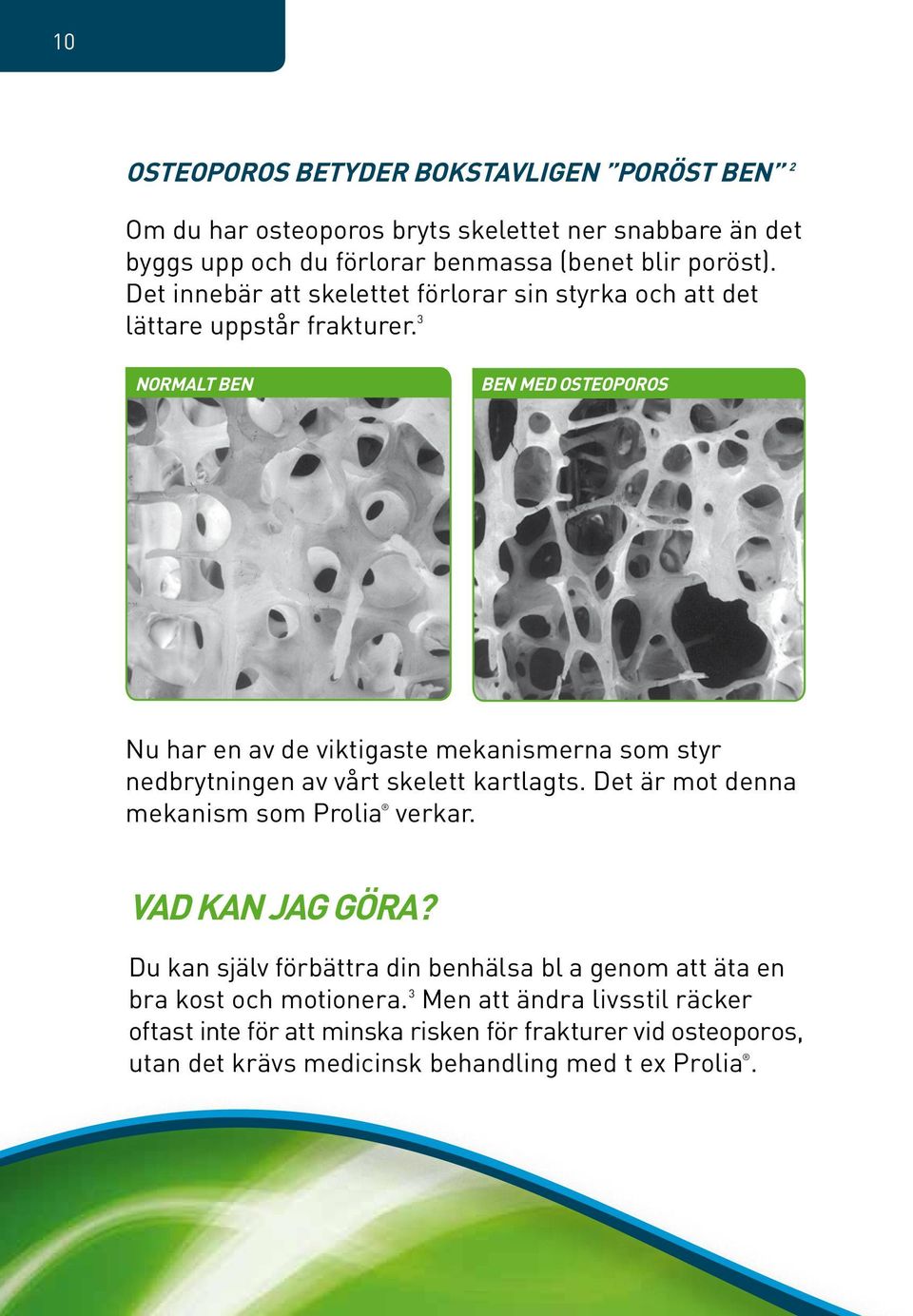 3 Normalt ben Ben med osteoporos Nu har en av de viktigaste mekanismerna som styr nedbrytningen av vårt skelett kartlagts.