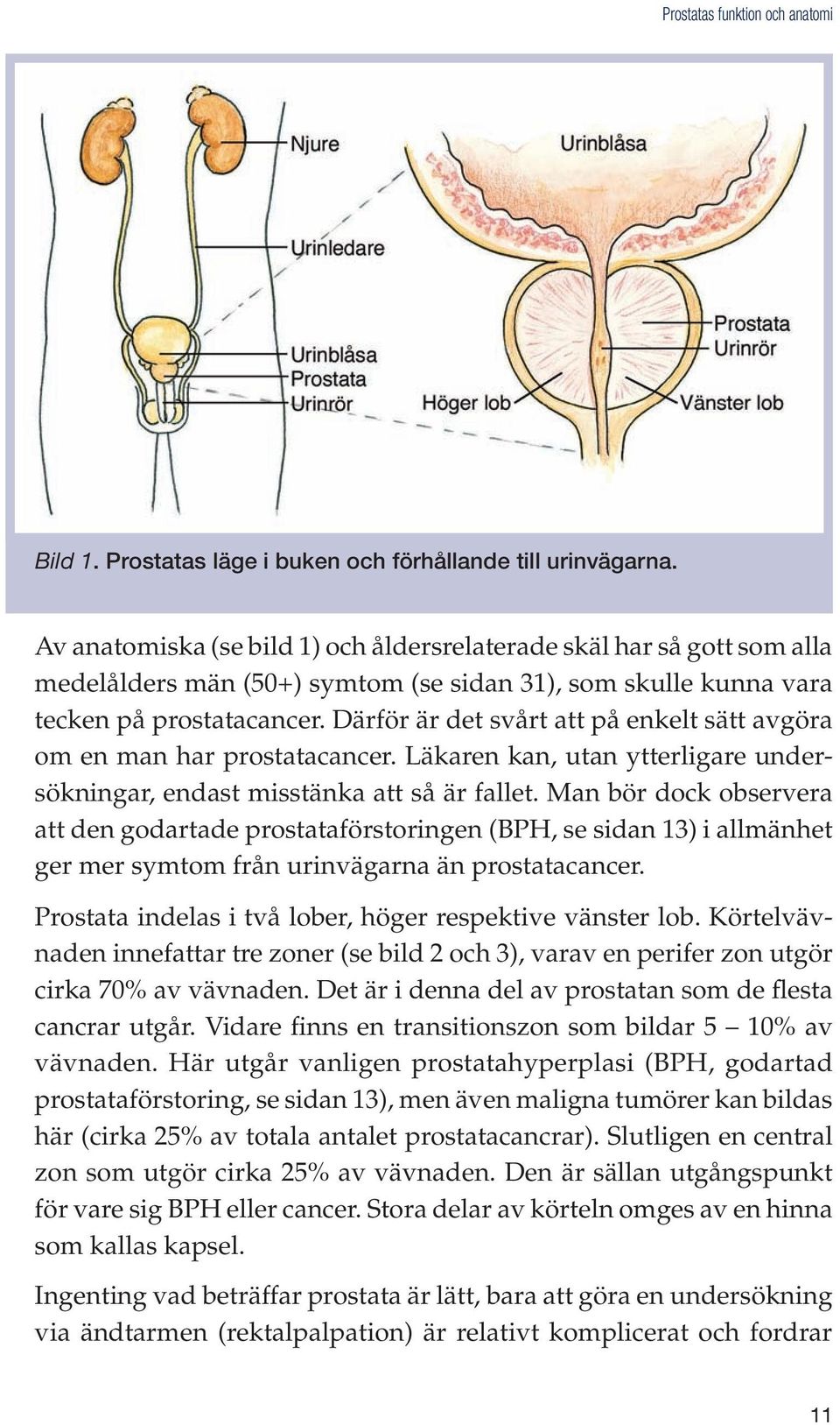 Därför är det svårt att på enkelt sätt avgöra om en man har prostatacancer. Läkaren kan, utan ytterligare undersökningar, endast misstänka att så är fallet.