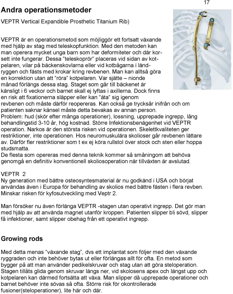 Dessa teleskoprör placeras vid sidan av kotpelaren, vilar på bäckenskovlarna eller vid kotbågarna i ländryggen och fästs med krokar kring revbenen.