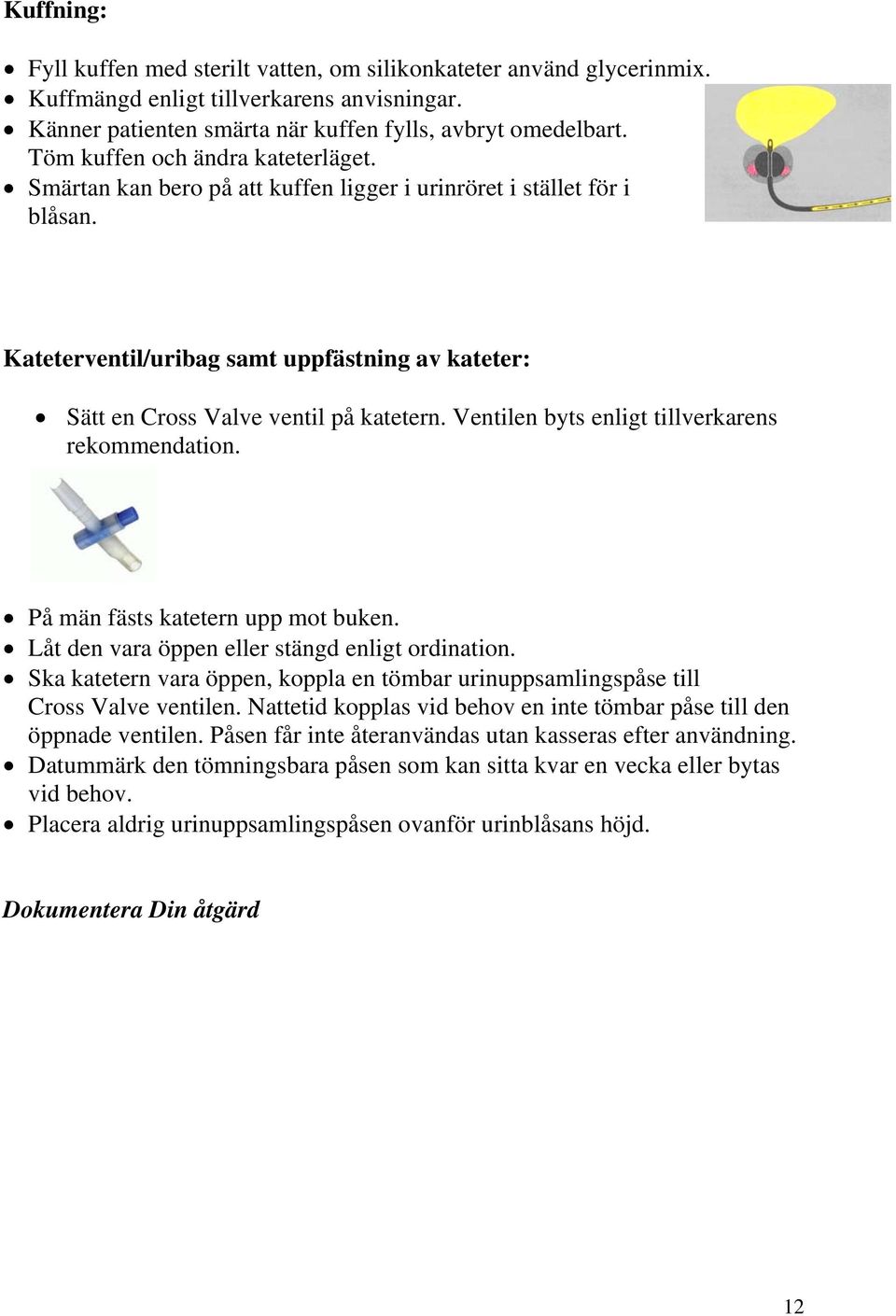 Ventilen byts enligt tillverkarens rekommendation. På män fästs katetern upp mot buken. Låt den vara öppen eller stängd enligt ordination.