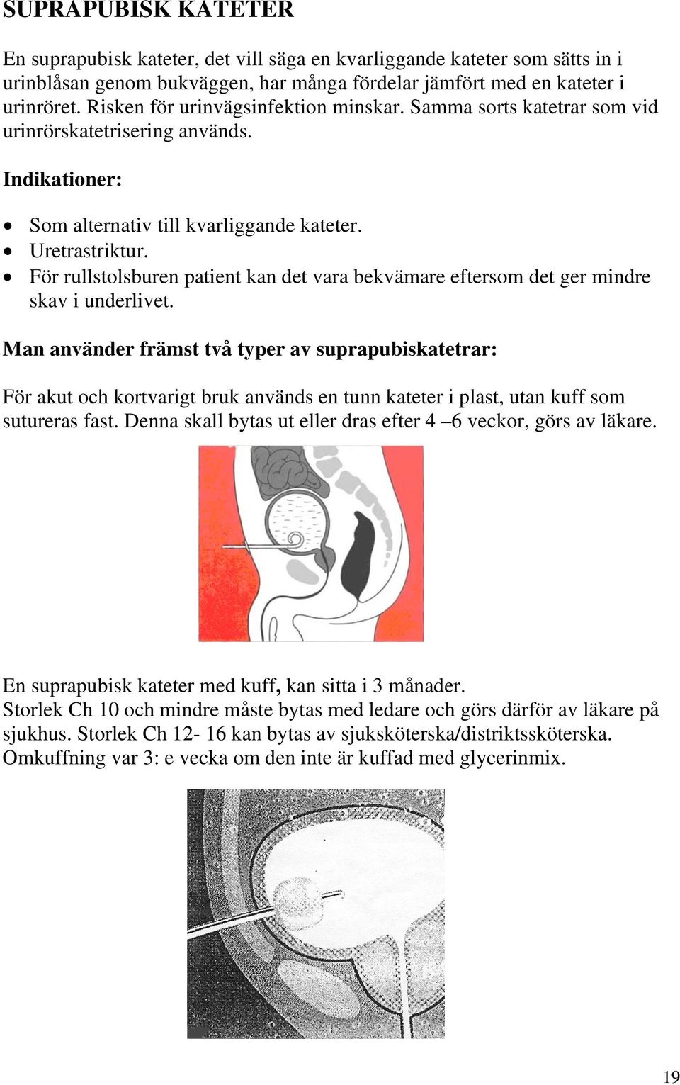 För rullstolsburen patient kan det vara bekvämare eftersom det ger mindre skav i underlivet.