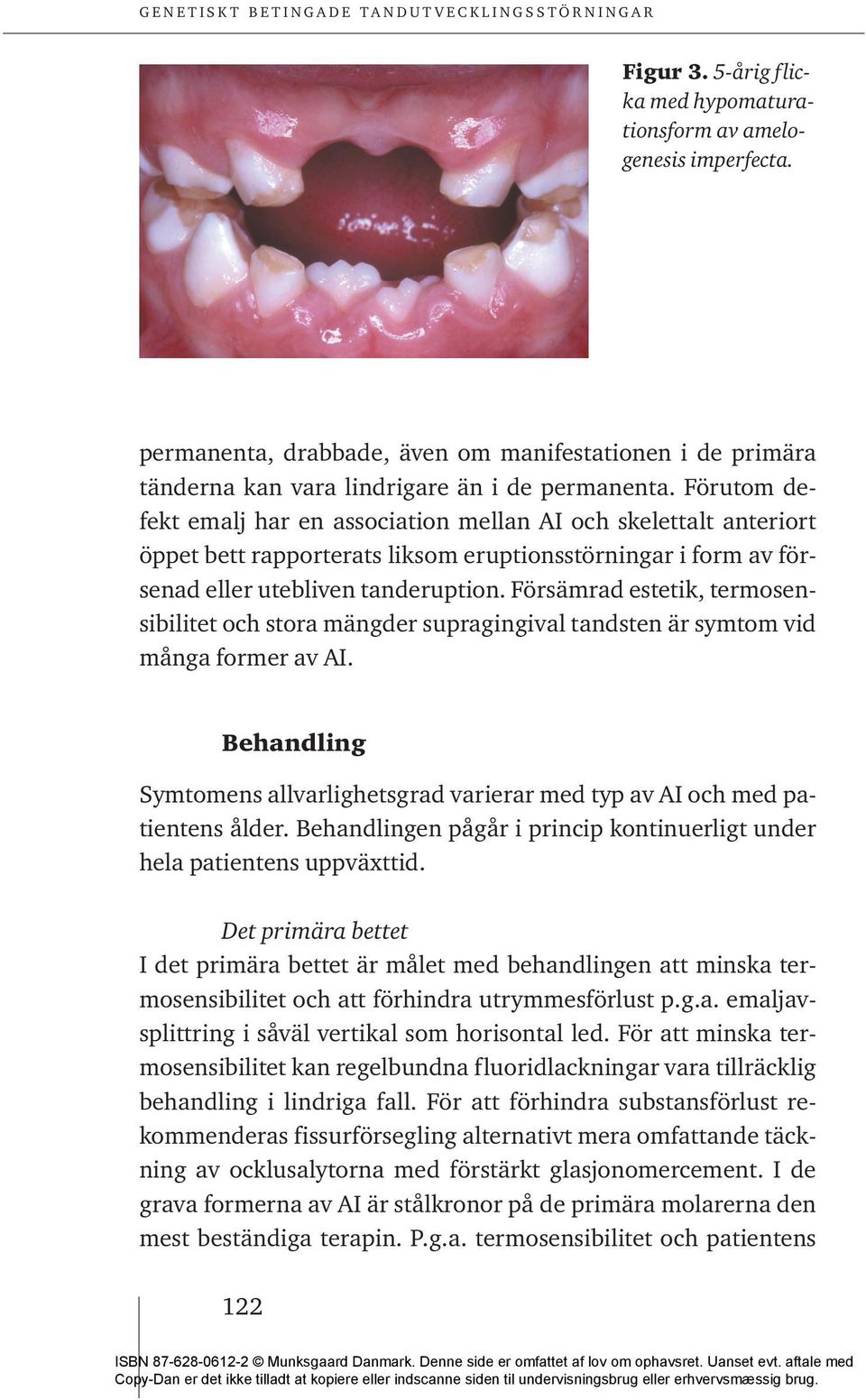 Försämrad estetik, termosensibilitet och stora mängder supragingival tandsten är symtom vid många former av AI. Behandling Symtomens allvarlighetsgrad varierar med typ av AI och med patientens ålder.