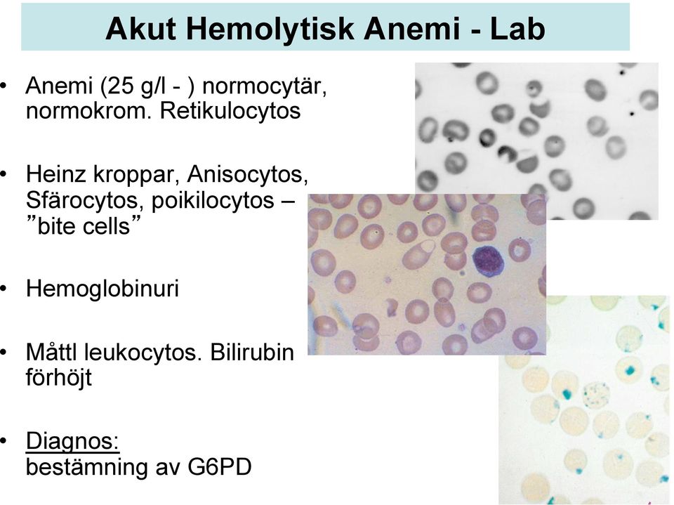 Retikulocytos Heinz kroppar, Anisocytos, Sfärocytos,