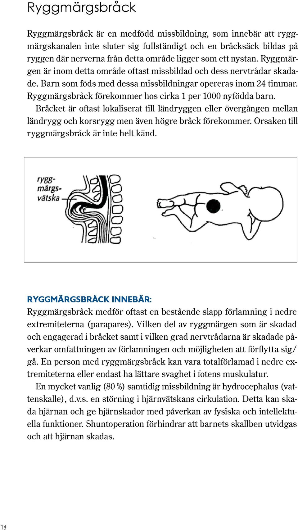 Ryggmärgsbråck förekommer hos cirka 1 per 1000 nyfödda barn. Bråcket är oftast lokaliserat till ländryggen eller övergången mellan ländrygg och korsrygg men även högre bråck förekommer.