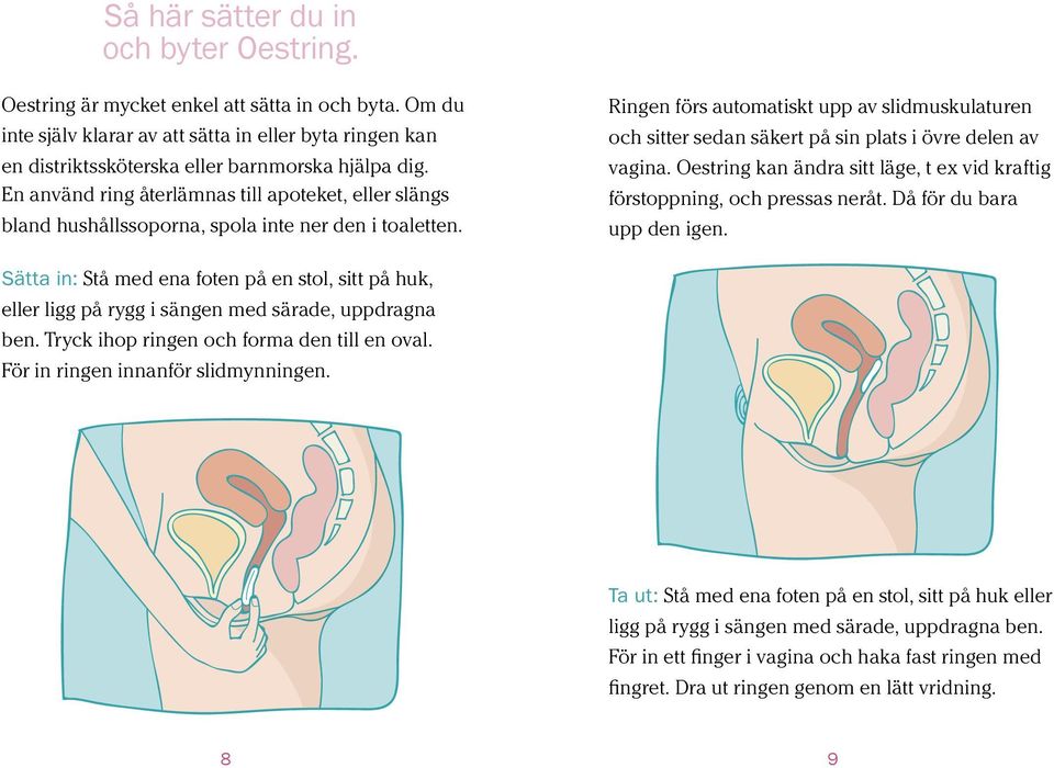 Ringen förs automatiskt upp av slidmuskulaturen och sitter sedan säkert på sin plats i övre delen av vagina. Oestring kan ändra sitt läge, t ex vid kraftig förstoppning, och pressas neråt.