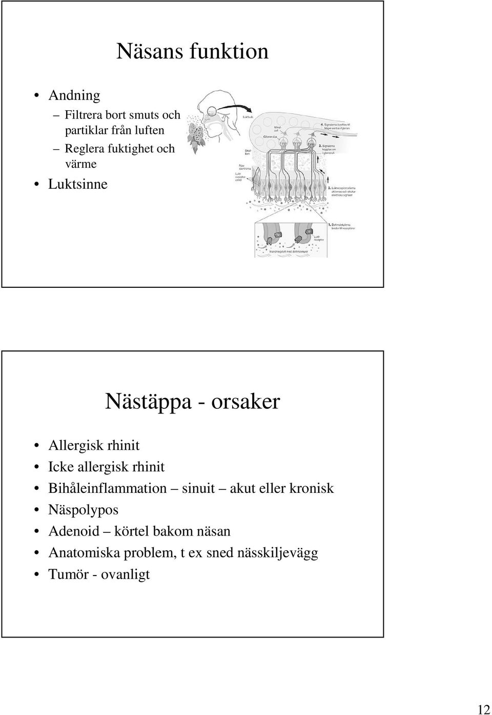 allergisk rhinit Bihåleinflammation sinuit akut eller kronisk Näspolypos