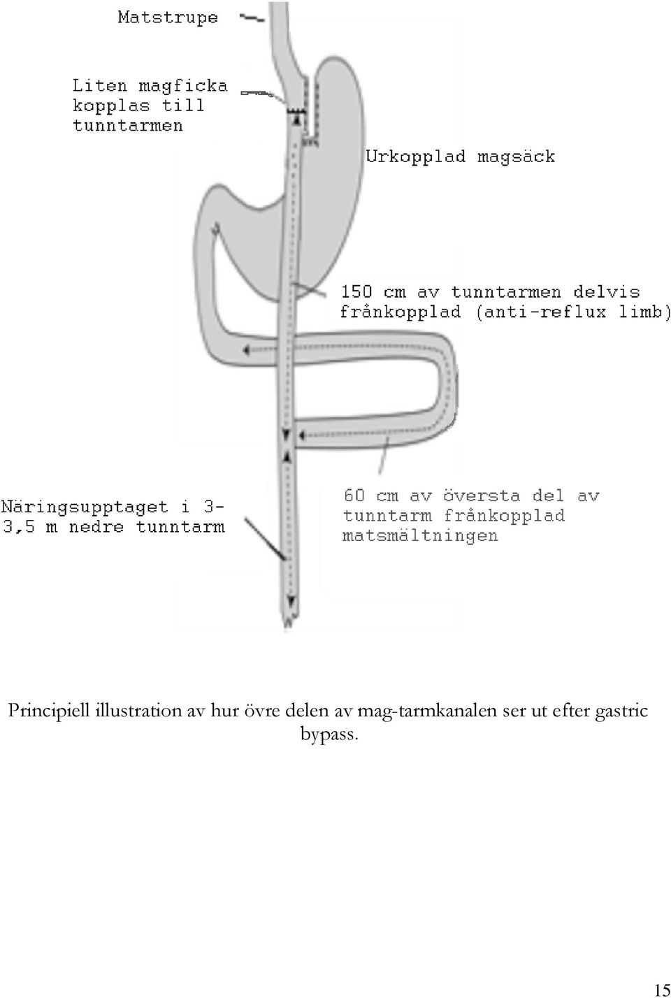 övre delen av