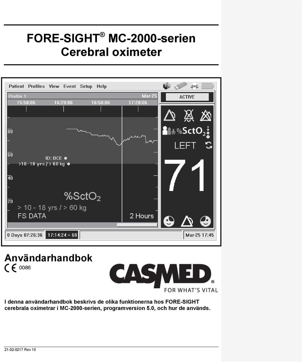 olika funktionerna hos FORE-SIGHT cerebrala oximetrar i