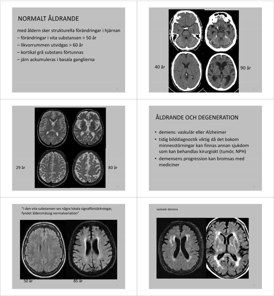 bilddiagnostik bldd viktig då det bakom bk minnesstörningar kan finnas annan sjukdom som kan behandlas kirurgiskt (tumör, NPH) demensens progression kan