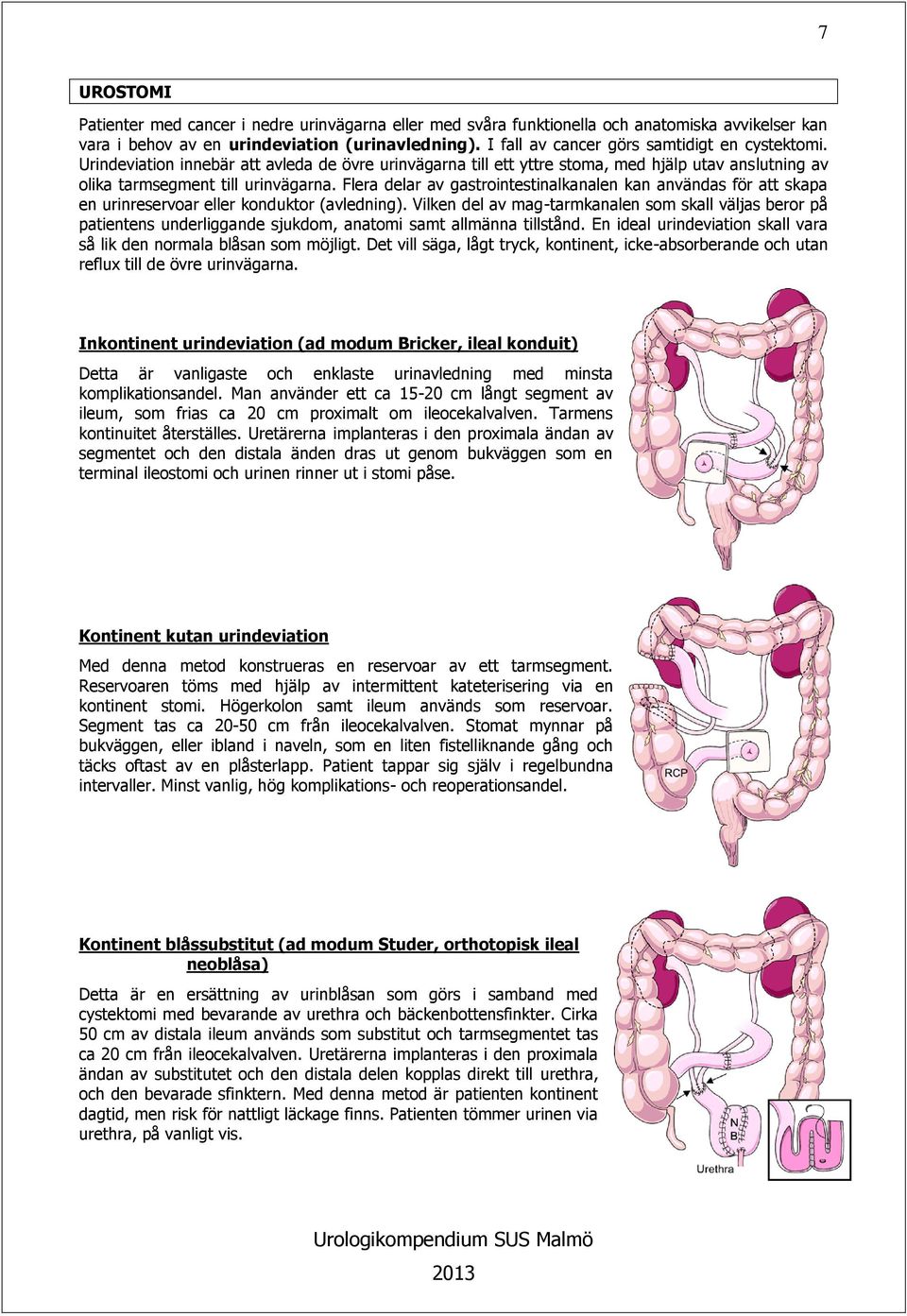 Flera delar av gastrointestinalkanalen kan användas för att skapa en urinreservoar eller konduktor (avledning).