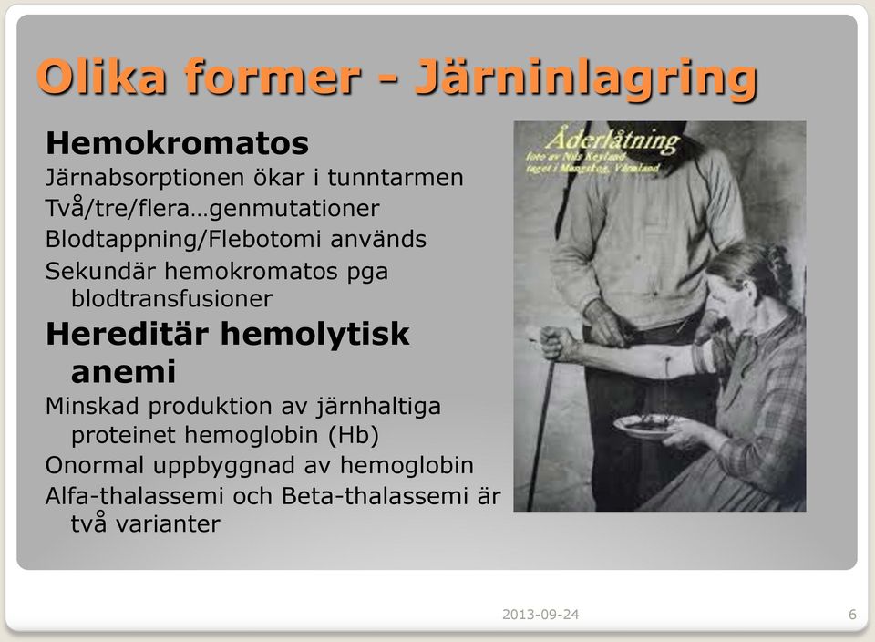 Hereditär hemolytisk anemi Minskad produktion av järnhaltiga proteinet hemoglobin (Hb)