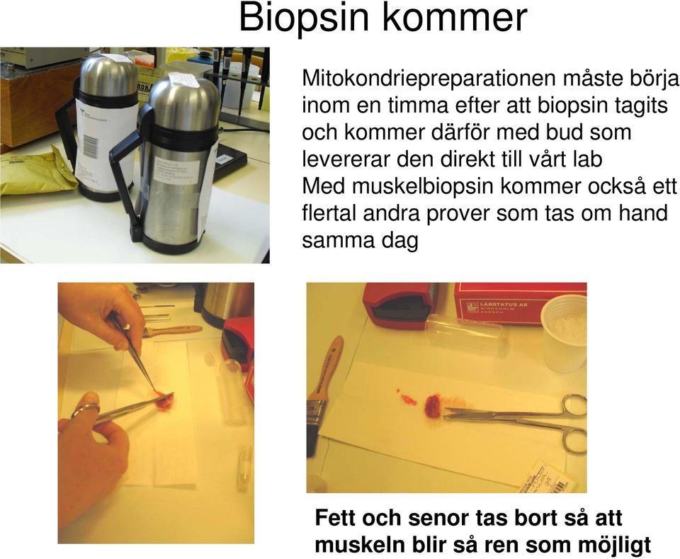 vårt lab Med muskelbiopsin kommer också ett flertal andra prover som tas