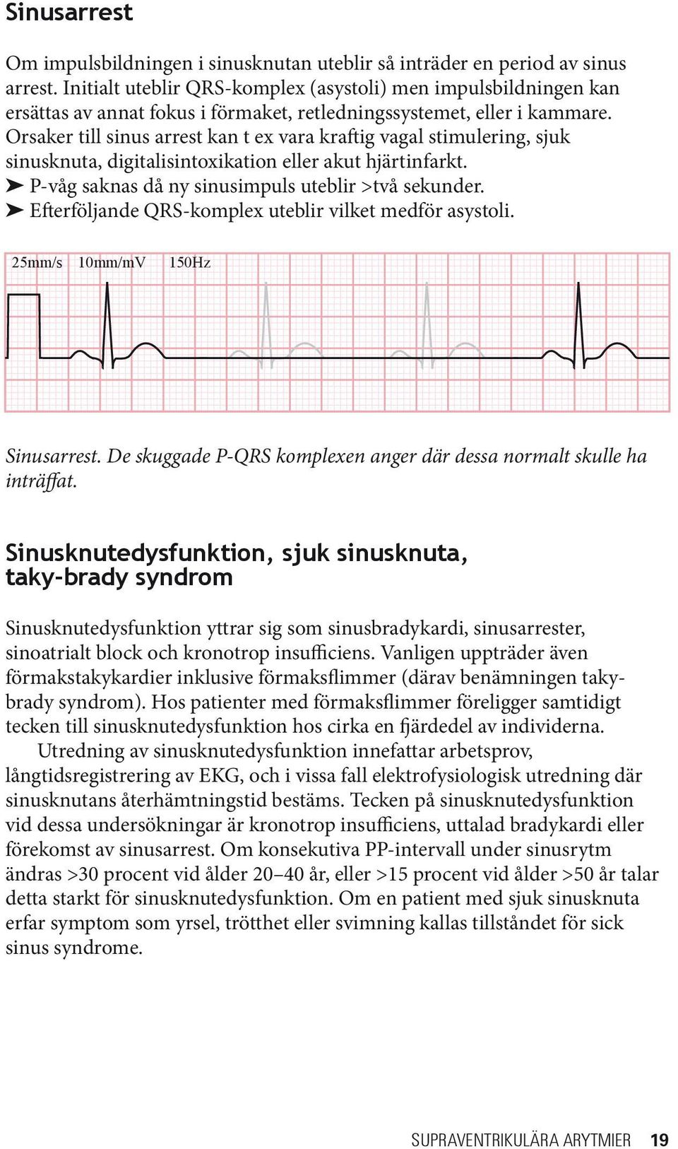 Orsaker till sinus arrest kan t ex vara kraftig vagal stimulering, sjuk sinusknuta, digitalisintoxikation eller akut hjärtinfarkt. P-våg saknas då ny sinusimpuls uteblir >två sekunder.