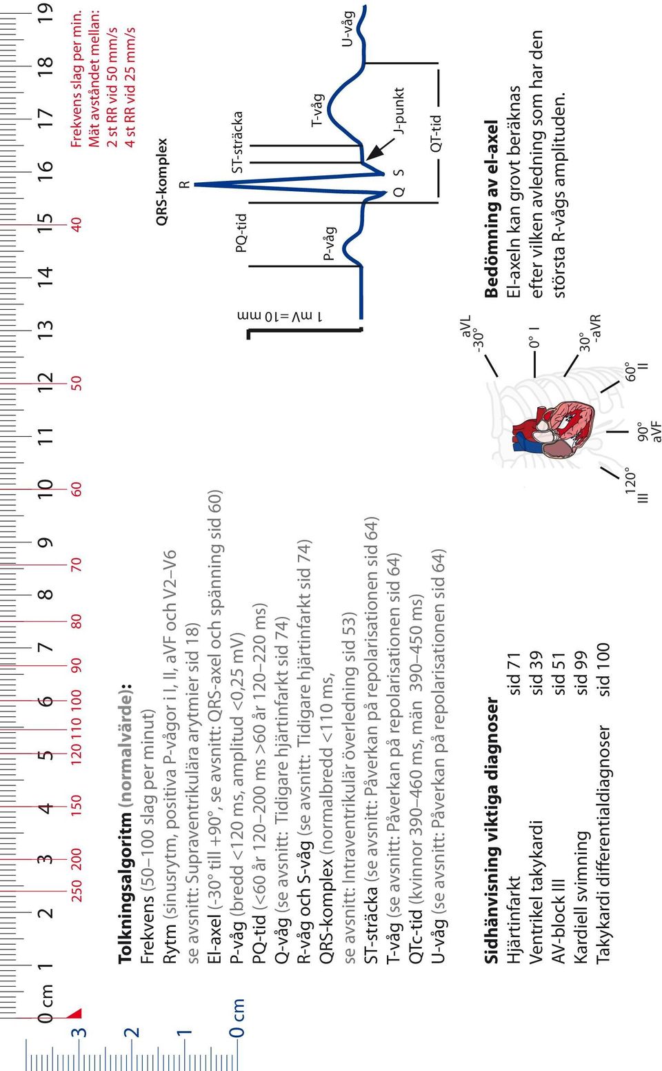 P-vågor i I, II, avf och V2 V6 se avsnitt: Supraventrikulära arytmier sid 18) El-axel (-30 till +90, se avsnitt: QRS-axel och spänning sid 60) P-våg (bredd <120 ms, amplitud <0,25 mv) PQ-tid (<60 år