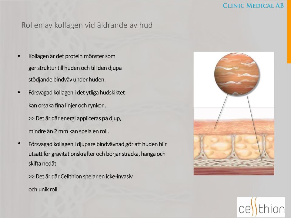 >> Det är där energi appliceras på djup, mindre än 2 mm kan spela en roll.