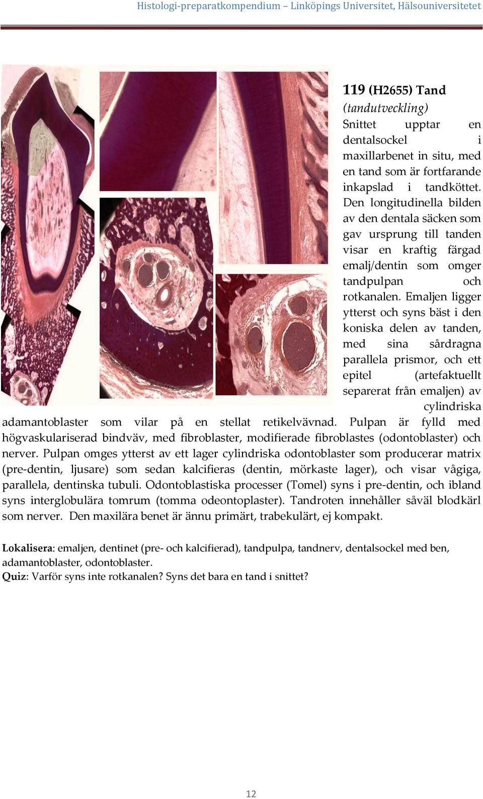 Emaljen ligger ytterst och syns bäst i den koniska delen av tanden, med sina sårdragna parallela prismor, och ett epitel (artefaktuellt separerat från emaljen) av cylindriska adamantoblaster som