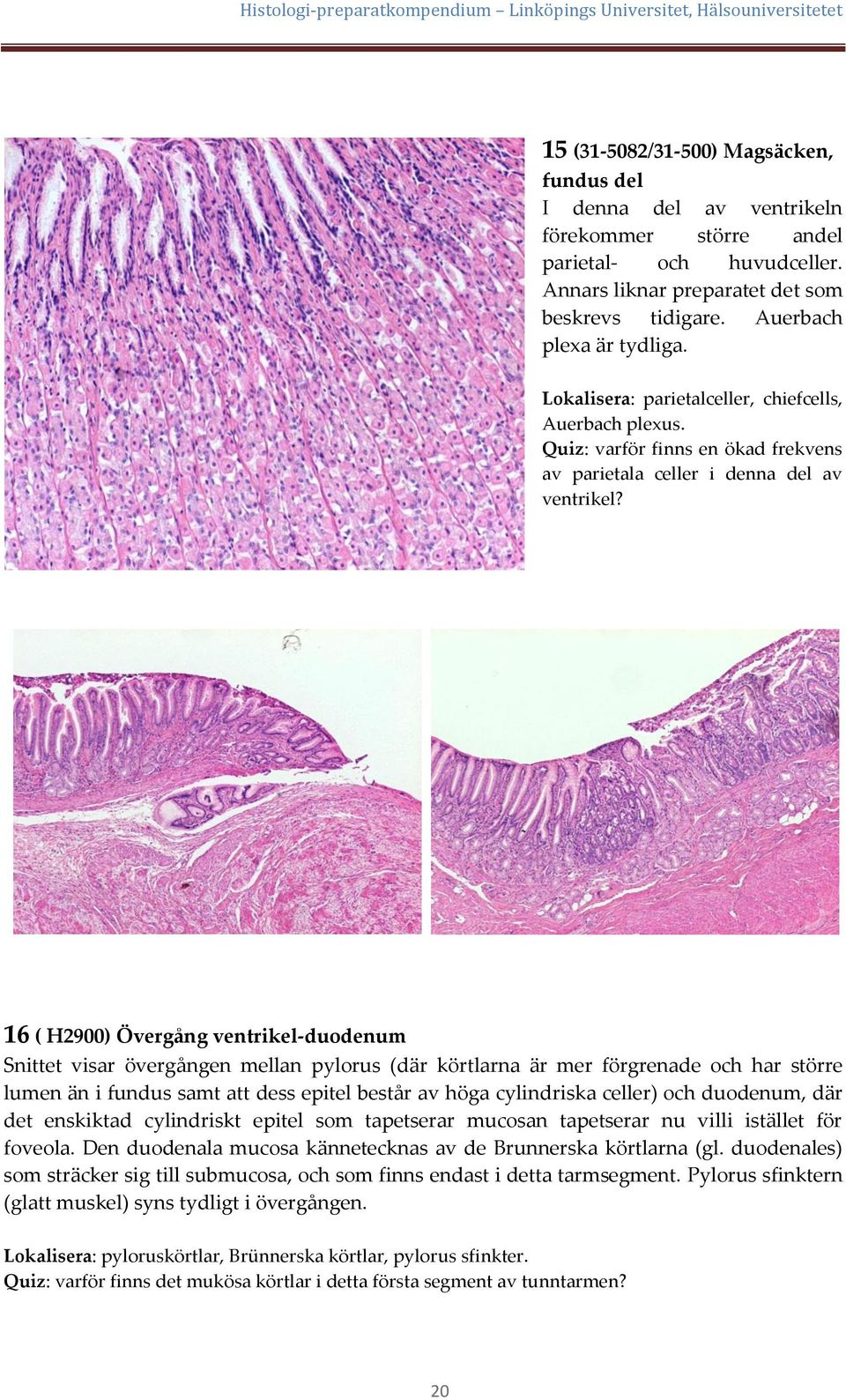 16 ( H2900) Övergång ventrikel-duodenum Snittet visar övergången mellan pylorus (där körtlarna är mer förgrenade och har större lumen än i fundus samt att dess epitel består av höga cylindriska