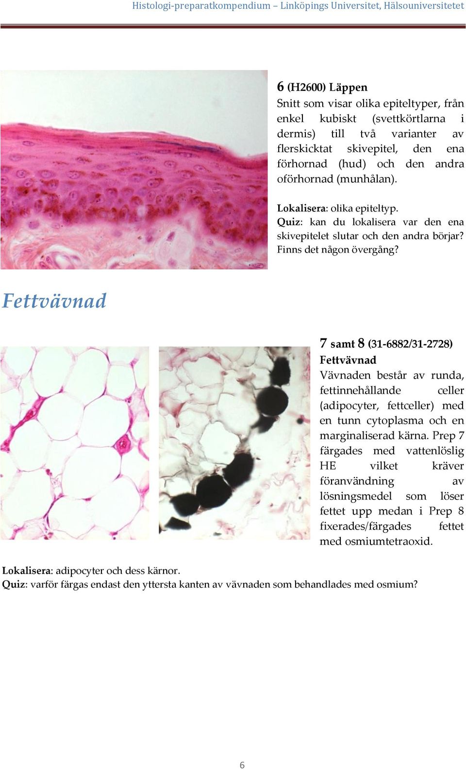 Fettvävnad 7 samt 8 (31-6882/31-2728) Fettvävnad Vävnaden består av runda, fettinnehållande celler (adipocyter, fettceller) med en tunn cytoplasma och en marginaliserad kärna.