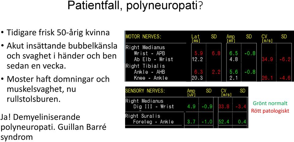 svaghet i händer och ben sedan en vecka.