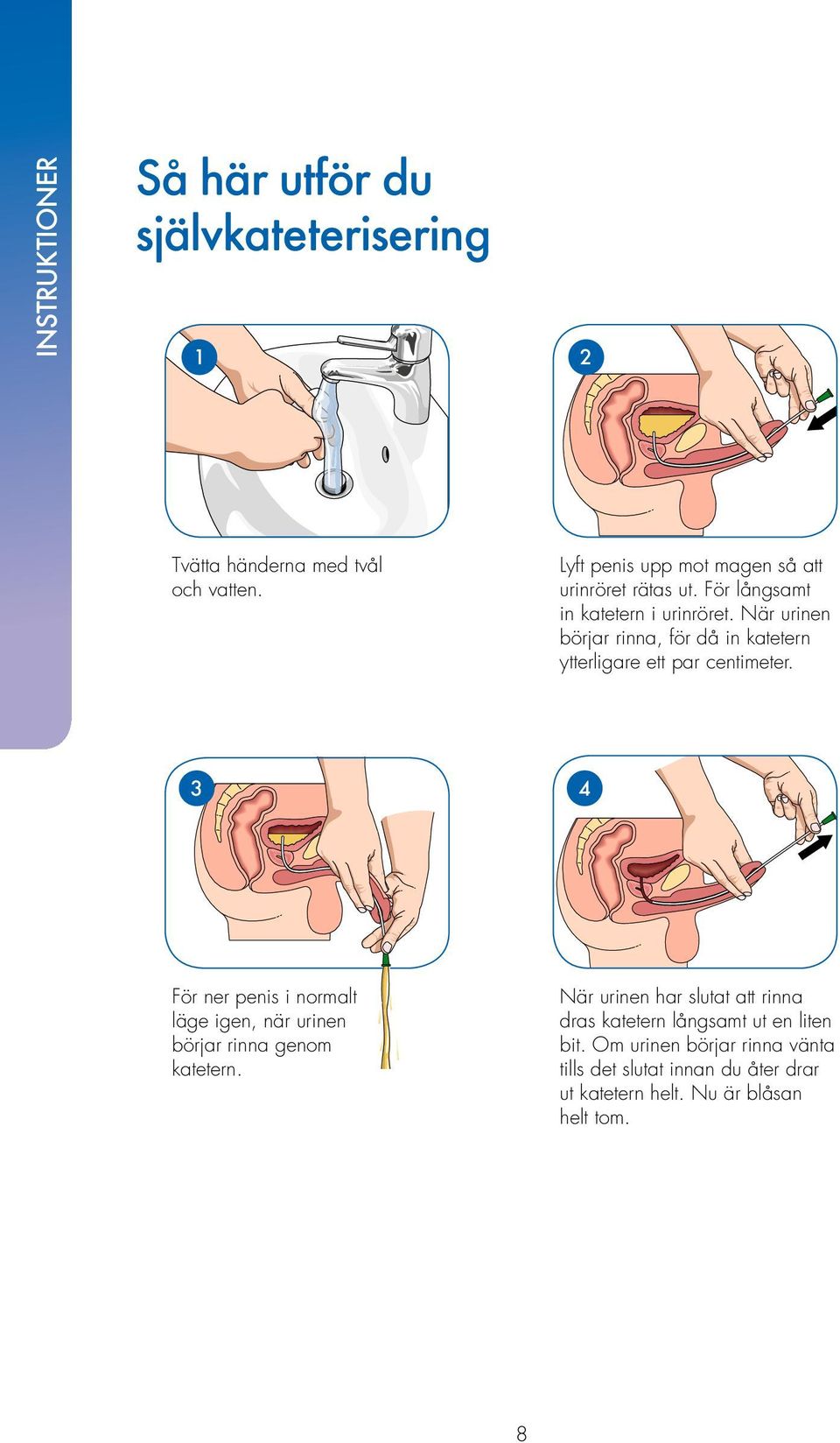 När urinen börjar rinna, för då in katetern ytterligare ett par centimeter.