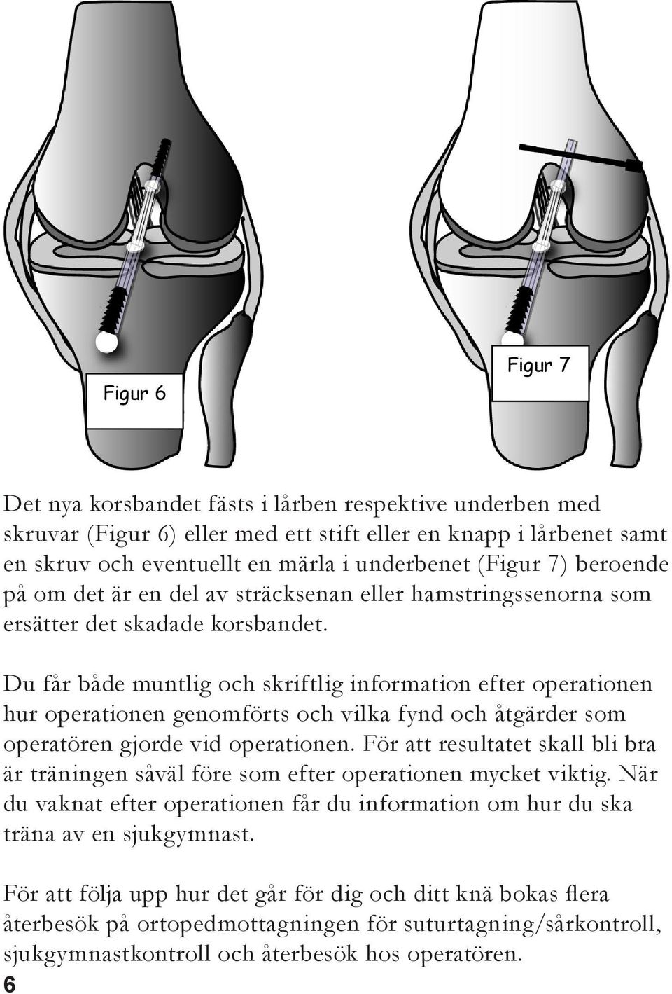 Du får både muntlig och skriftlig information efter operationen hur operationen genomförts och vilka fynd och åtgärder som operatören gjorde vid operationen.