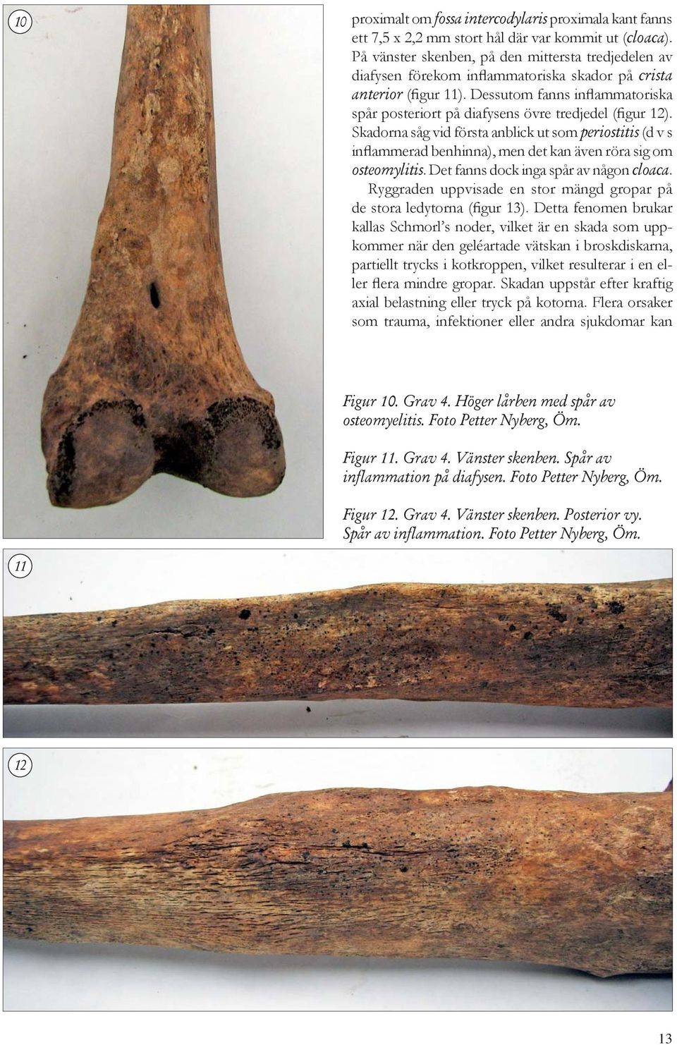 Dessutom fanns inflammatoriska spår posteriort på diafysens övre tredjedel (figur 12).