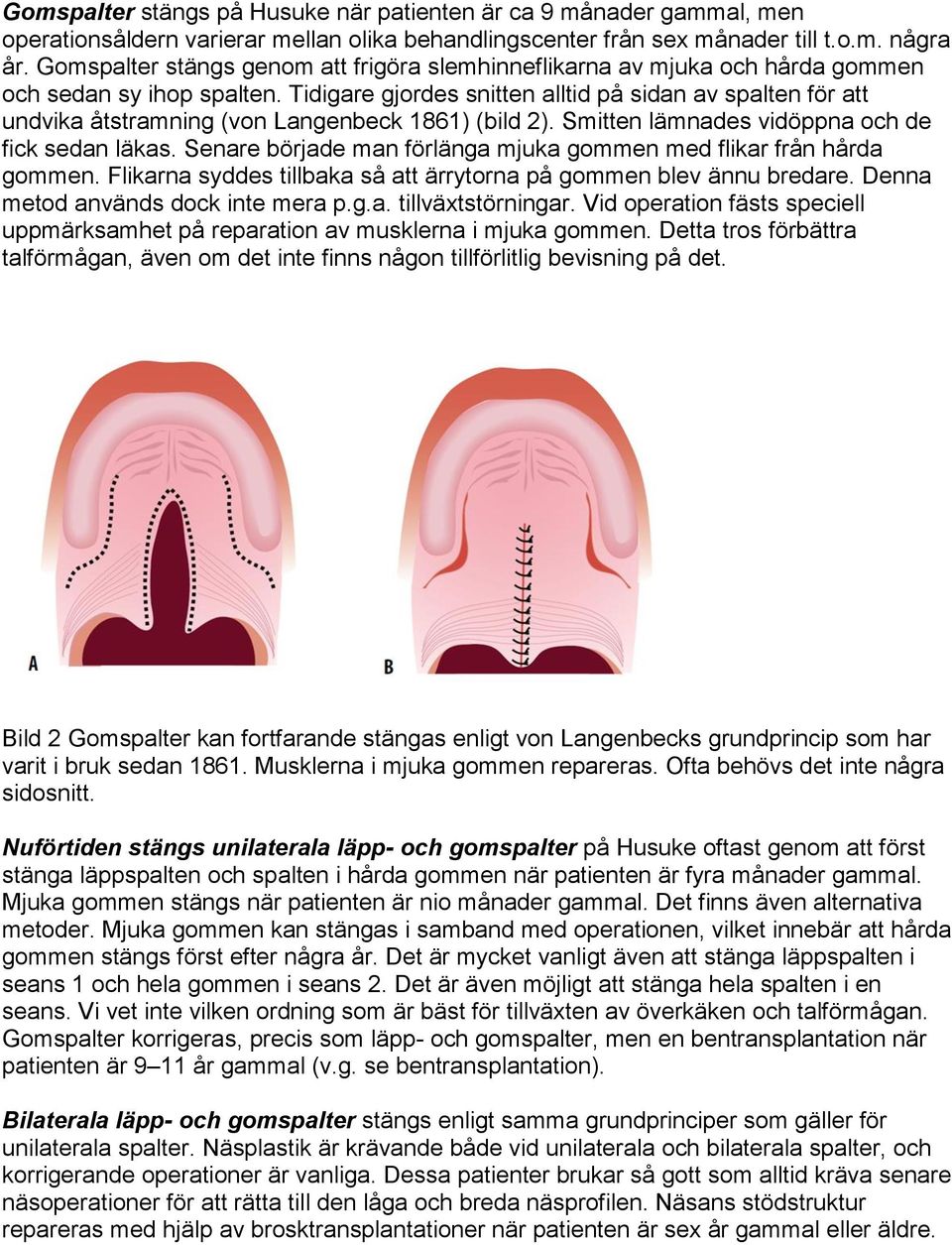 Tidigare gjordes snitten alltid på sidan av spalten för att undvika åtstramning (von Langenbeck 1861) (bild 2). Smitten lämnades vidöppna och de fick sedan läkas.