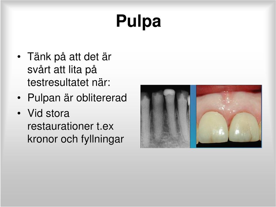 Pulpan är oblitererad Vid stora