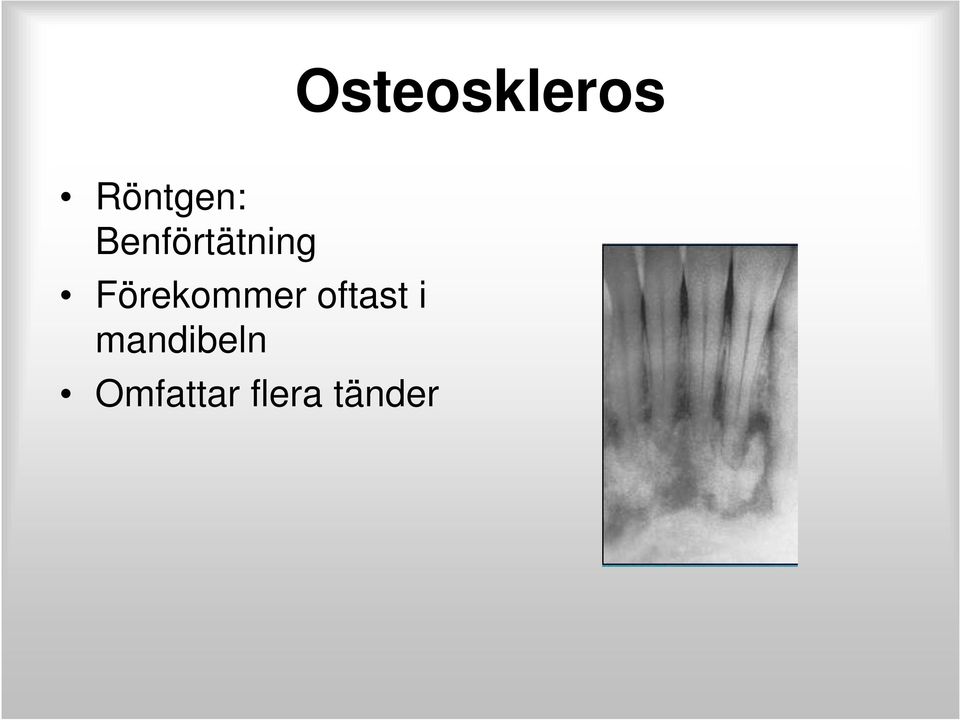 Förekommer oftast i