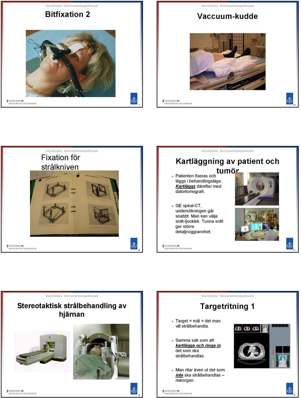 Tunna snitt ger större detaljnoggrannhet. 8 11 Stereotaktisk strålbehandling av hjärnan Target = mål = det man vill strålbehandla.