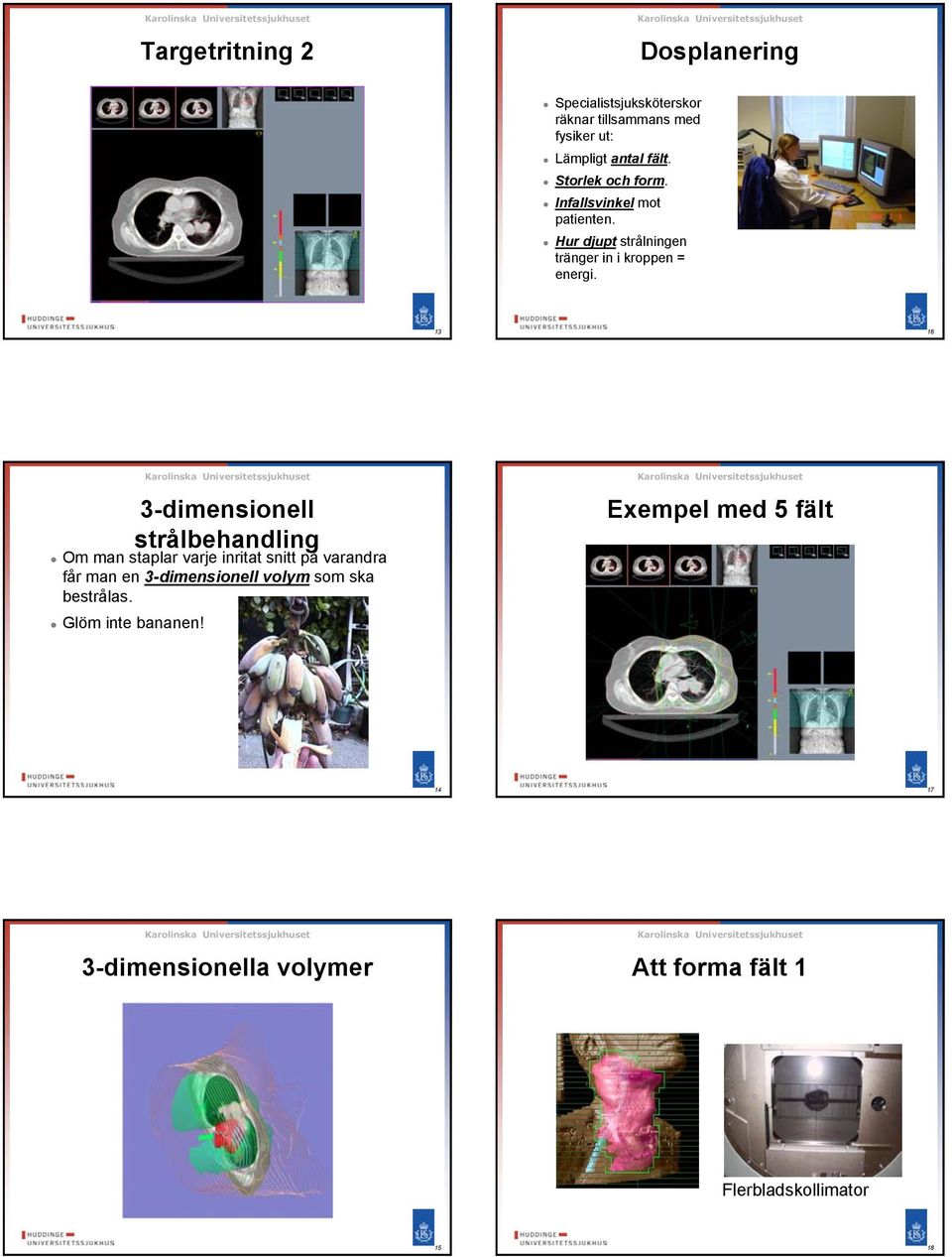 16 3-dimensionell strålbehandling Om man staplar varje inritat snitt på varandra får man en 3-dimensionell volym