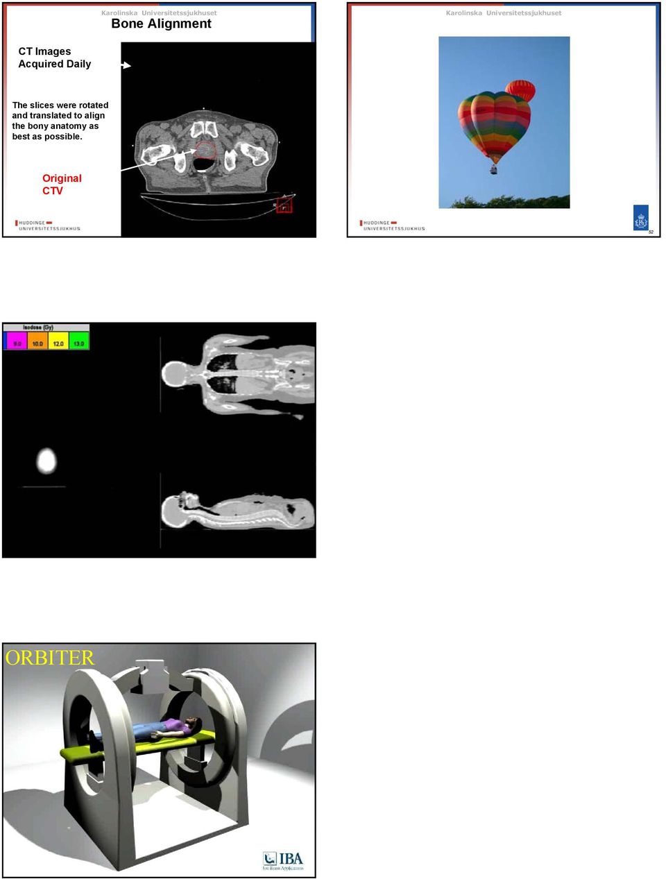 translated to align the bony anatomy as