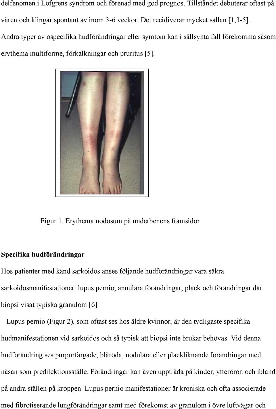 Erythema nodosum på underbenens framsidor Specifika hudförändringar Hos patienter med känd sarkoidos anses följande hudförändringar vara säkra sarkoidosmanifestationer: lupus pernio, annulära