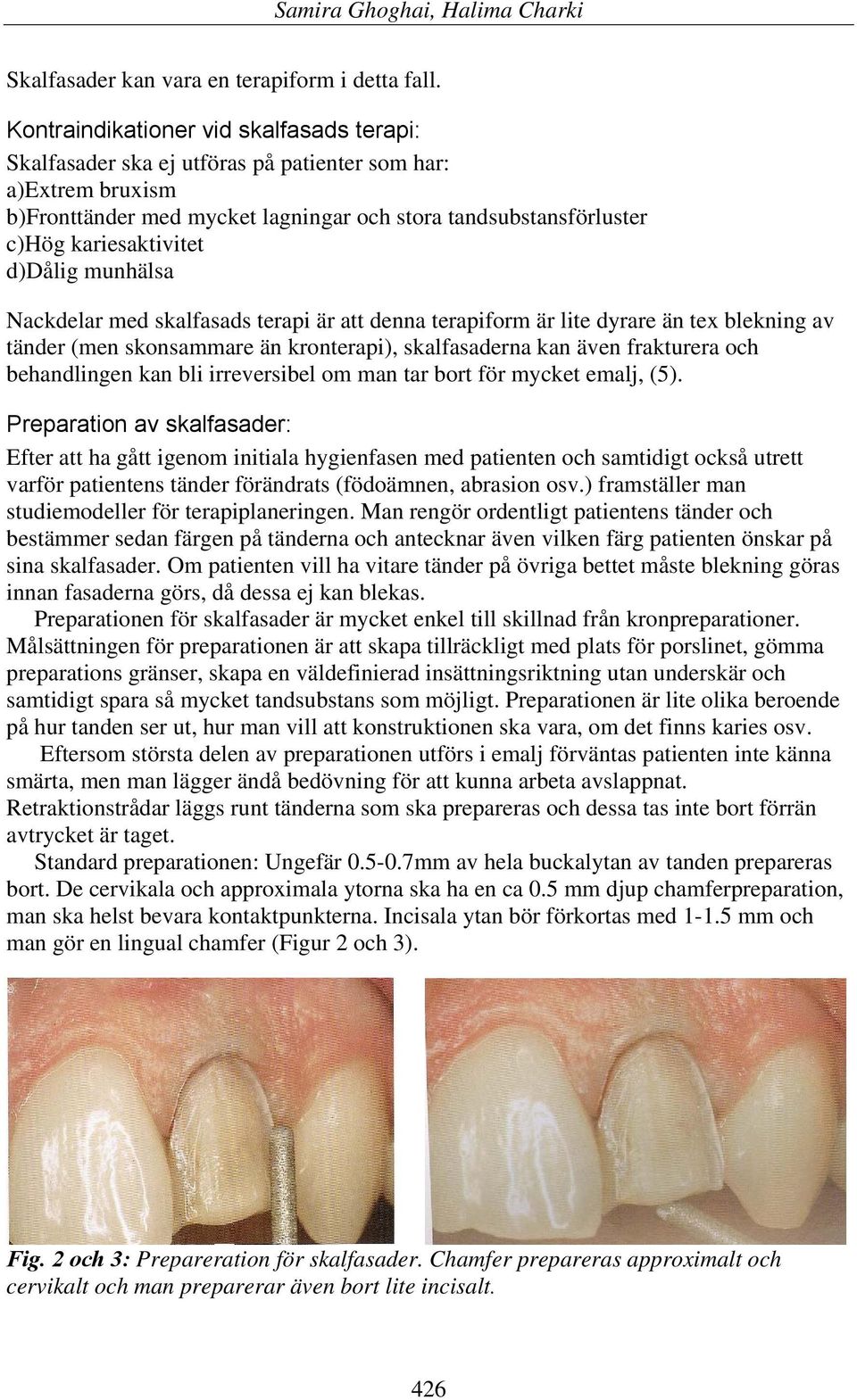 d)dålig munhälsa Nackdelar med skalfasads terapi är att denna terapiform är lite dyrare än tex blekning av tänder (men skonsammare än kronterapi), skalfasaderna kan även frakturera och behandlingen