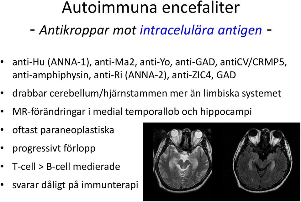 cerebellum/hjärnstammen mer än limbiska systemet MR-förändringar i medial temporallob och