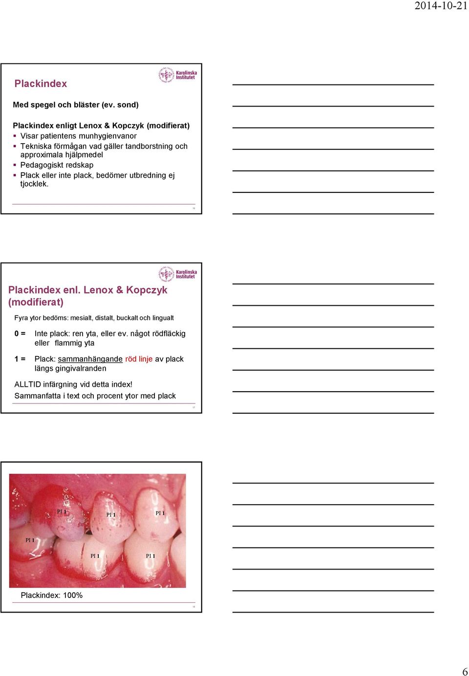 Pedagogiskt redskap Plack eller inte plack, bedömer utbredning ej tjocklek. 16 Plackindex enl.