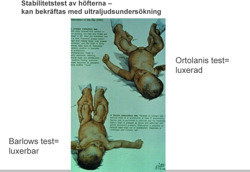 ultraljudsundersökning