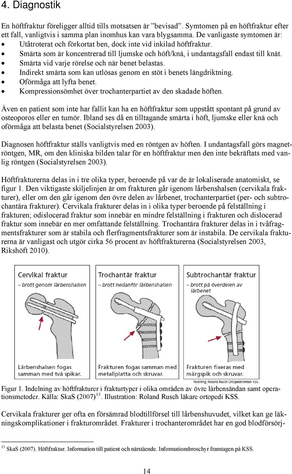 Smärta vid varje rörelse och när benet belastas. Indirekt smärta som kan utlösas genom en stöt i benets längdriktning. Oförmåga att lyfta benet.