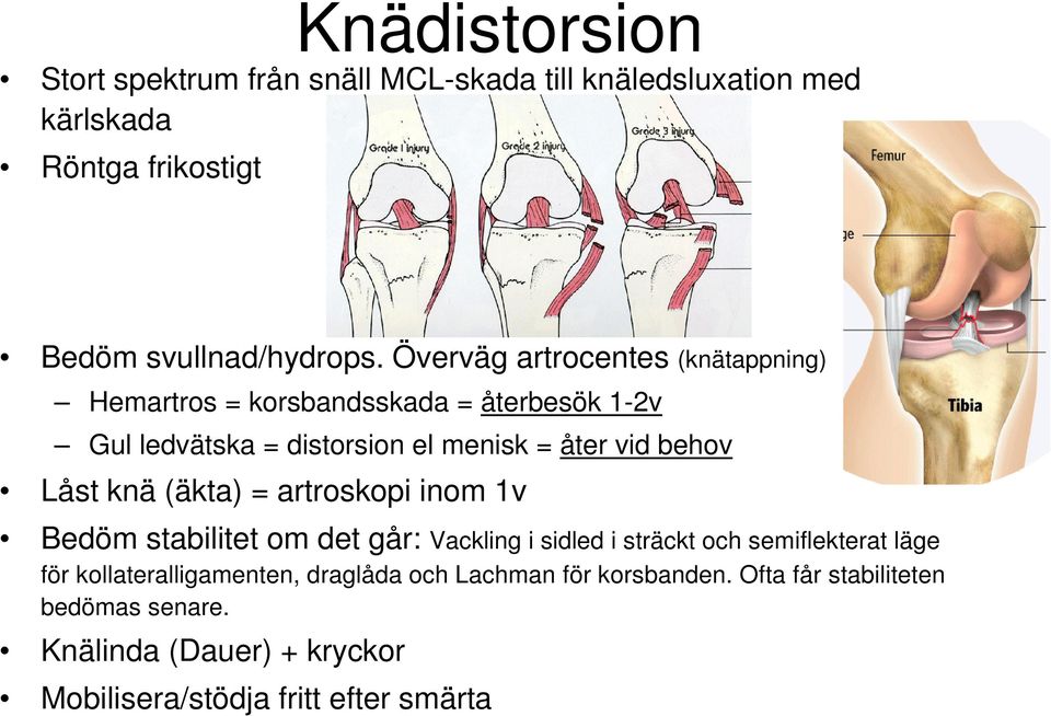 Låst knä (äkta) = artroskopi inom 1v Bedöm stabilitet om det går: Vackling i sidled i sträckt och semiflekterat läge för