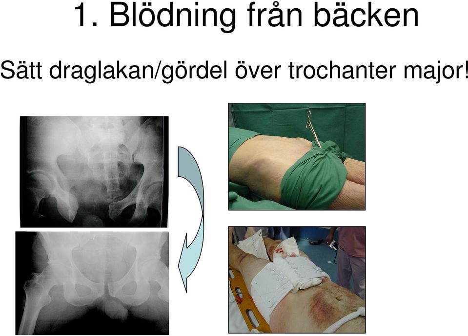 draglakan/gördel