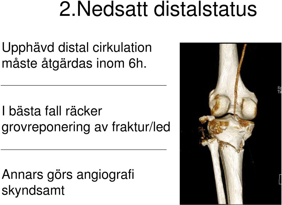 I bästa fall räcker grovreponering av